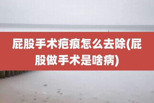 屁股手术疤痕怎么去除(屁股做手术是啥病)