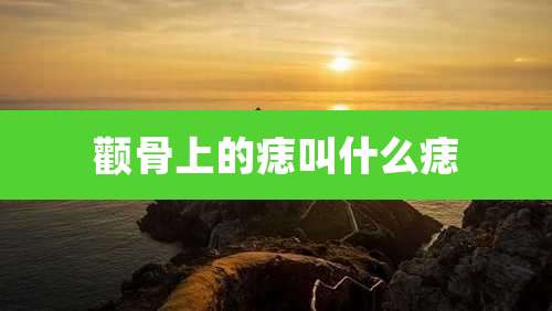 颧骨上的痣叫什么痣