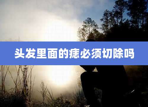 头发里面的痣必须切除吗