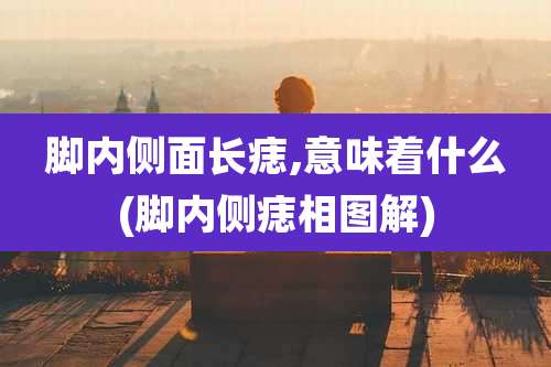 脚内侧面长痣,意味着什么(脚内侧痣相图解)