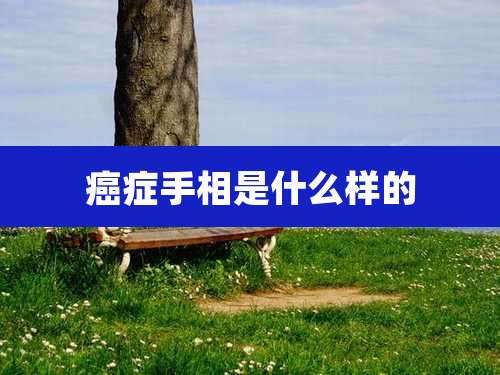癌症手相是什么样的