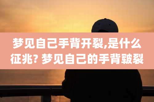 梦见自己手背开裂,是什么征兆? 梦见自己的手背皲裂