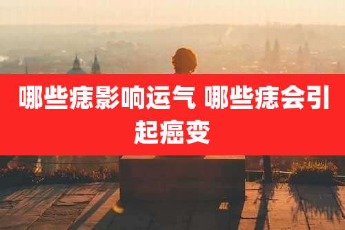 哪些痣影响运气 哪些痣会引起癌变